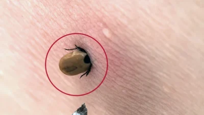 Kocaeli’de bahar güneşinin açmasıyla mesire alanları dolarken, kene riski de