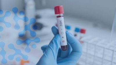 Kocaeli’de Gönüllü Danışmanlık ve Test Merkezi’nde vatandaşlar kimlik bilgilerini paylaşmadan