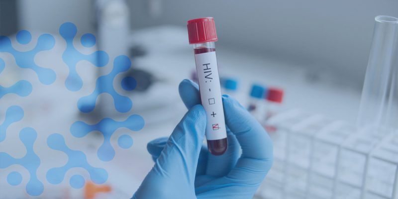 Kocaeli’de Gönüllü Danışmanlık ve Test Merkezi’nde vatandaşlar kimlik bilgilerini paylaşmadan